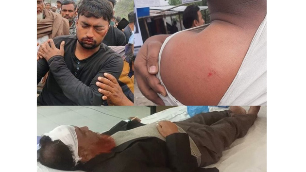 জাজিরার পশ্চিম নাওডোবায় ইউপি নির্বাচনকে কেন্দ্রকরে প্রতিপক্ষের হামলায় ৫জন আহত