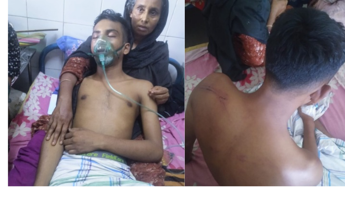 ধুলদী বাজারে চাঁদা না দেওয়ায় যুবককে পিটিয়ে গুরুতর জখম