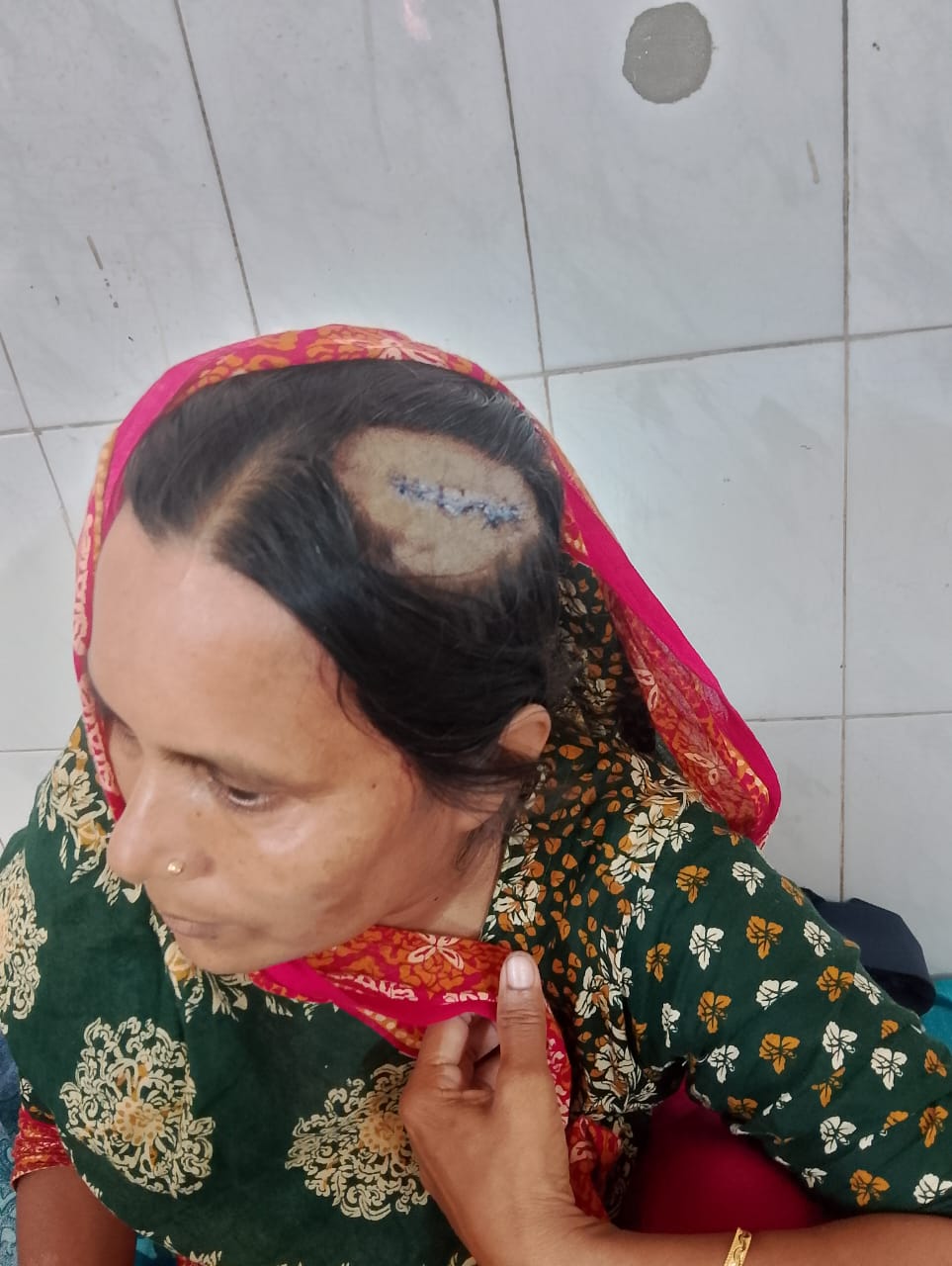 শরীয়তপুরে আওয়ামীলীগ নেতার বিরুদ্ধে স্ত্রীকে কুপিয়ে হত্যার চেষ্টা !