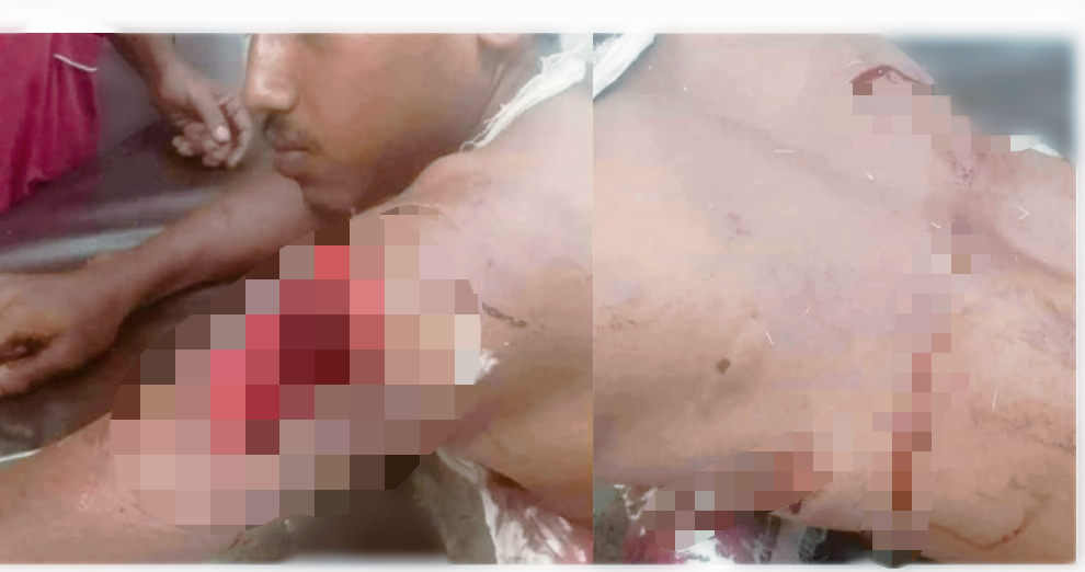 শরীয়তপুরে ইমারত শ্রমিককে কুপিয়ে হত্যার চেষ্টা, গুরুতর আহত অবস্থায় হাসপাতালে
