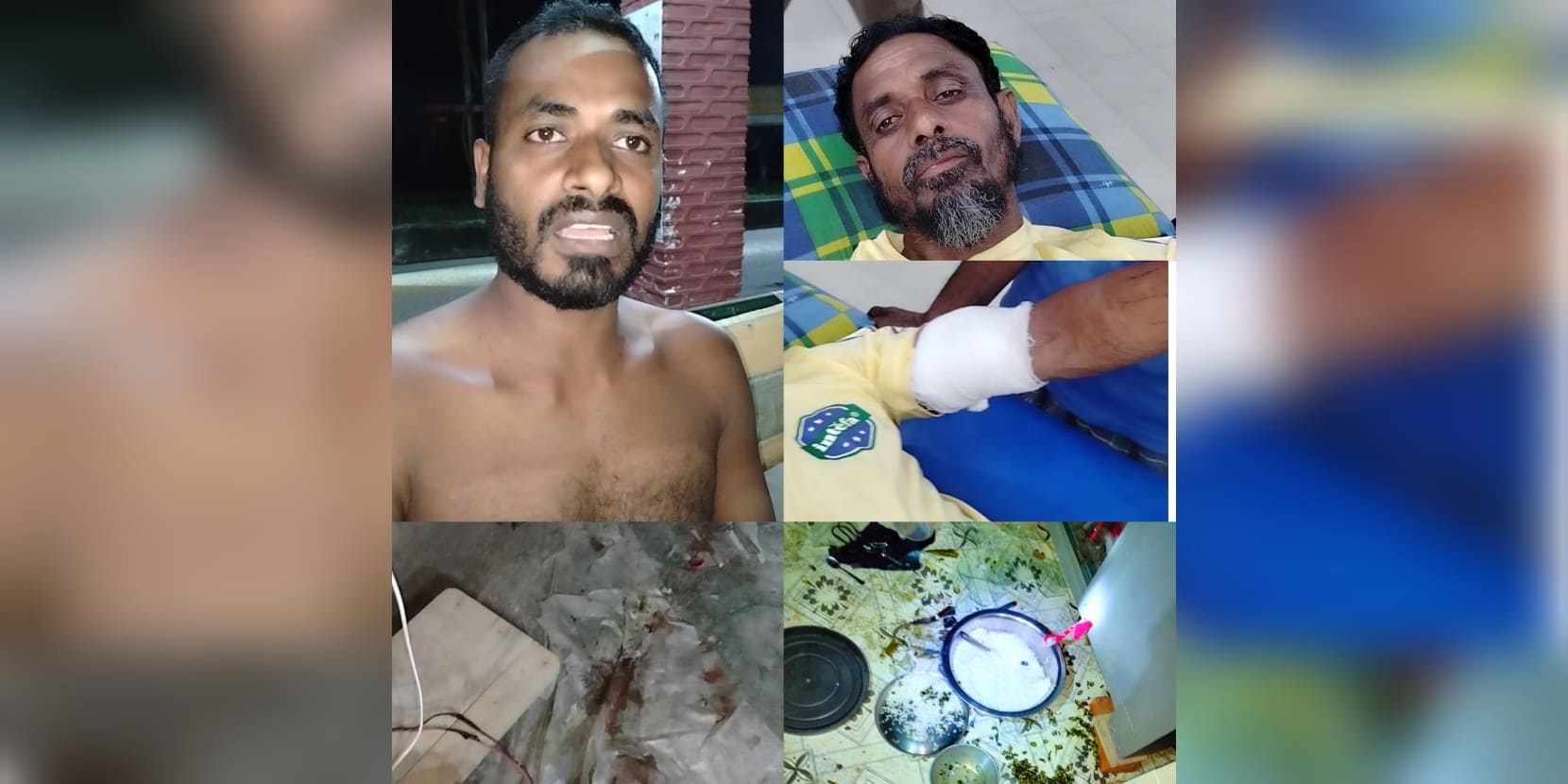 বরগুনার আমতলীতে ছাগলকে কেন্দ্র করে রক্তক্ষয়ী সংঘর্ষে আহত ৩, একজন বরিশাল মেডিকেলে ভর্তি।